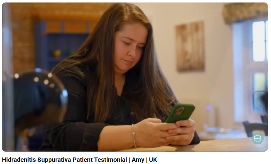 Amy’s Story “Hidradenitis suppurativa stopped me from being with my friends”